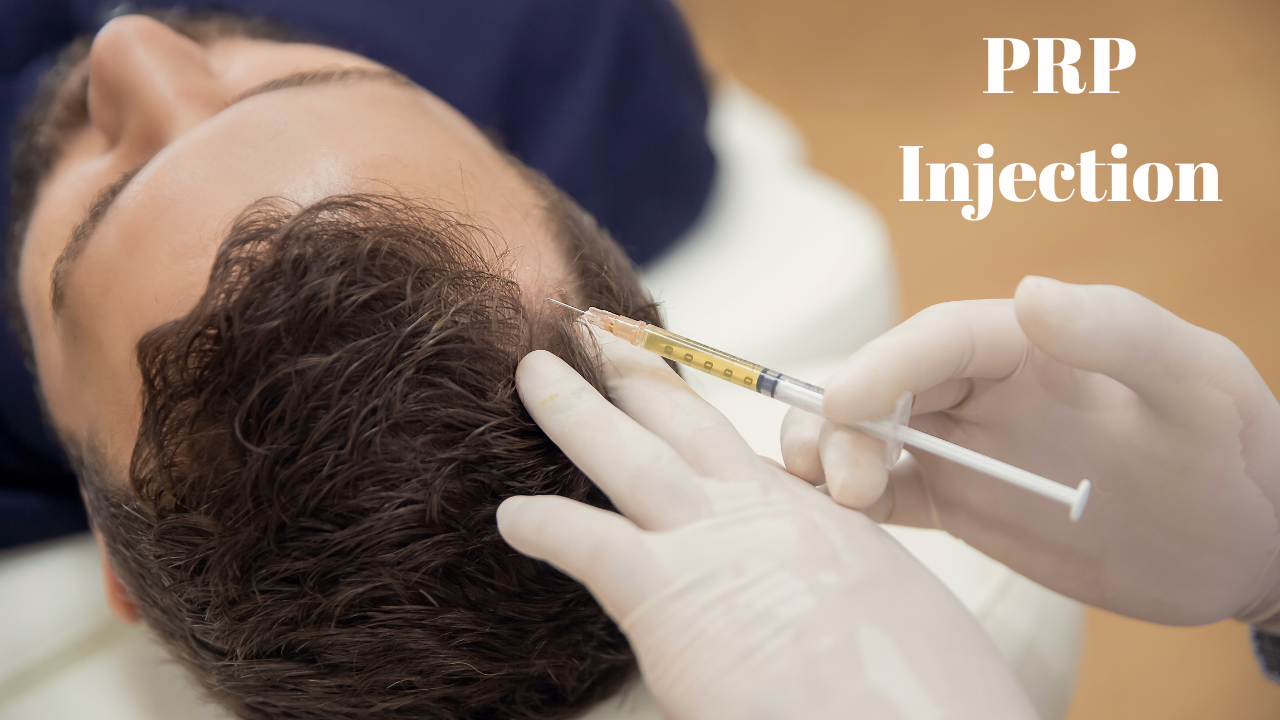 PRP-INJECTION-TREATMENT-FOR-HAIR-LOSS