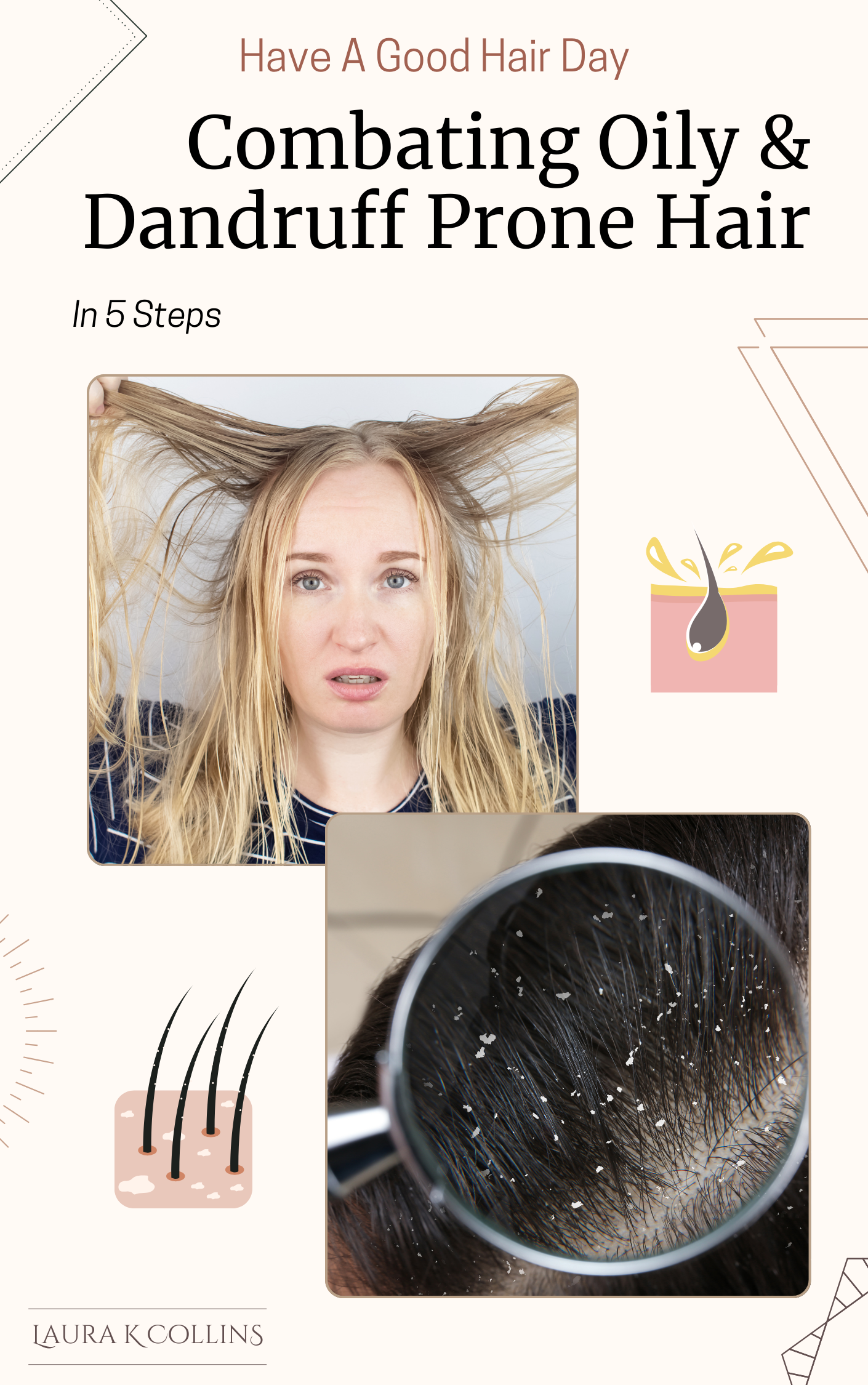 COMBATING-OILY-AND-DANDRUFF-PRONE-HAIR-IN-5-STEPS-COVER-PHOTO